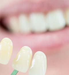 Zahnästhethik Löwenstein - Zahnbleaching und Zahnaufhellung